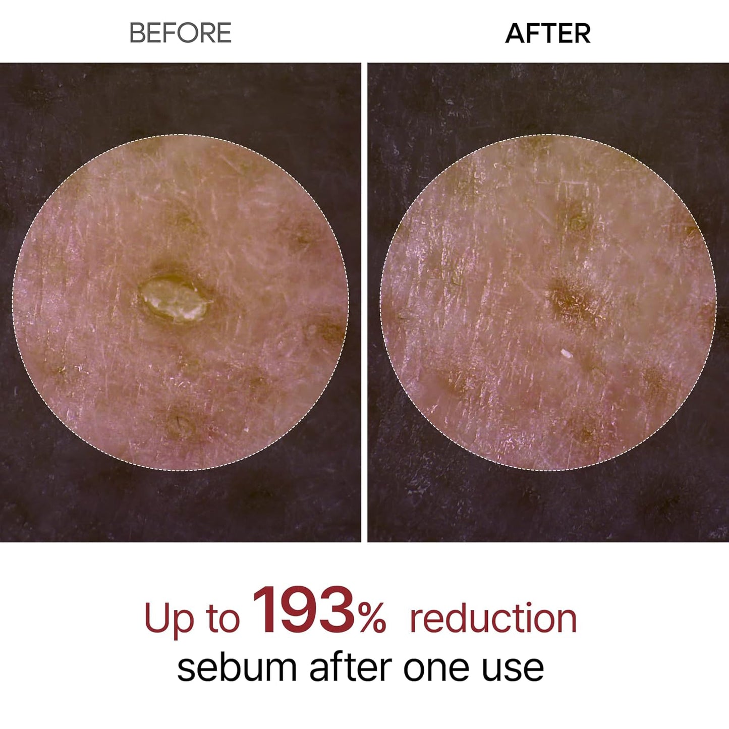 Dr. Melaxin Rice Exfoliating Serum – Hydrating, Pore-Minimizing & Blackhead Removal Skincare