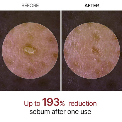 Dr. Melaxin Rice Exfoliating Serum – Hydrating, Pore-Minimizing & Blackhead Removal Skincare